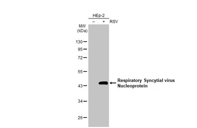 Anti-Respiratory Syncytial virus Nucleoprotein antibody [HL1295] used in Western Blot (WB). GTX636709