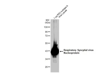 Anti-Respiratory Syncytial virus Nucleoprotein antibody [HL1295] used in Western Blot (WB). GTX636709