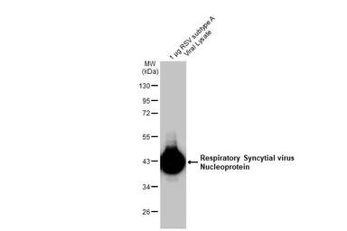 Anti-Respiratory Syncytial virus Nucleoprotein antibody [HL1296] used in Western Blot (WB). GTX636710