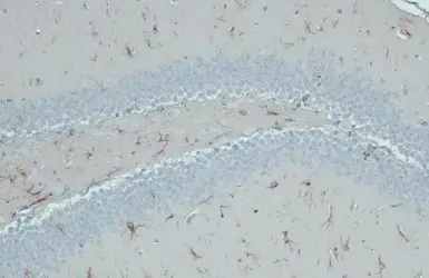 Anti-GFAP antibody [HL1308] used in IHC (Paraffin sections) (IHC-P). GTX636726