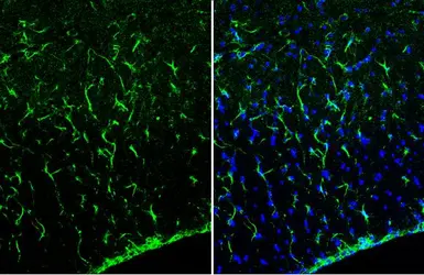 Anti-GFAP antibody [HL1308] used in IHC (Frozen sections) (IHC-Fr). GTX636726