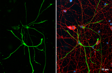 Anti-GFAP antibody [HL1308] used in Immunocytochemistry/ Immunofluorescence (ICC/IF). GTX636726