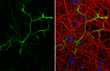 Anti-GFAP antibody [HL1308] used in Immunocytochemistry/ Immunofluorescence (ICC/IF). GTX636726