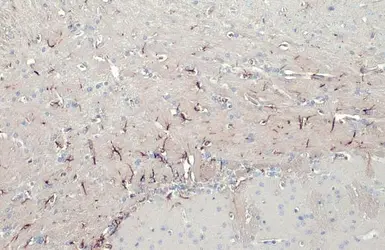 Anti-GFAP antibody [HL1308] used in IHC (Paraffin sections) (IHC-P). GTX636726