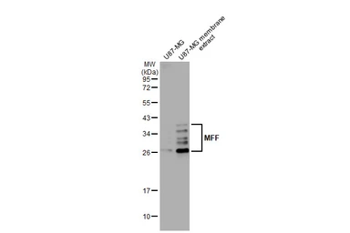 Anti-MFF antibody [HL1311] used in Western Blot (WB). GTX636729