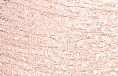 Anti-MFF antibody [HL1311] used in IHC (Paraffin sections) (IHC-P). GTX636729