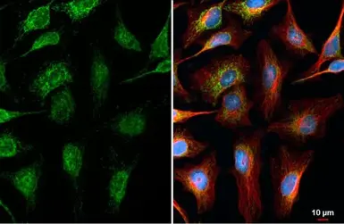 Anti-MFF antibody [HL1311] used in Immunocytochemistry/ Immunofluorescence (ICC/IF). GTX636729