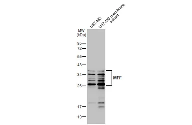 Anti-MFF antibody [HL1312] used in Western Blot (WB). GTX636730