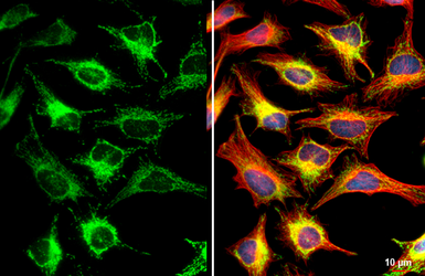 Anti-MFF antibody [HL1312] used in Immunocytochemistry/ Immunofluorescence (ICC/IF). GTX636730