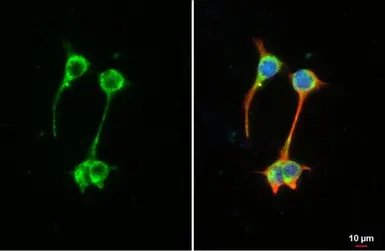 Anti-MFF antibody [HL1312] used in Immunocytochemistry/ Immunofluorescence (ICC/IF). GTX636730