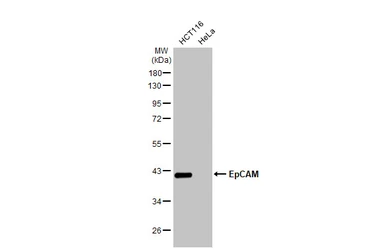 Anti-EpCAM antibody [HL1338] used in Western Blot (WB). GTX636758