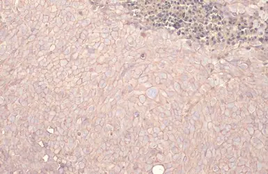 Anti-EpCAM antibody [HL1338] used in IHC (Paraffin sections) (IHC-P). GTX636758