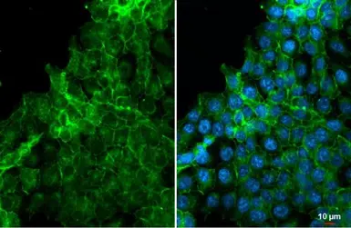 Anti-EpCAM antibody [HL1338] used in Immunocytochemistry/ Immunofluorescence (ICC/IF). GTX636758