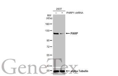 Anti-PARP antibody [HL1365] used in Western Blot (WB). GTX636805