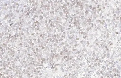 Anti-PARP antibody [HL1365] used in IHC (Paraffin sections) (IHC-P). GTX636805