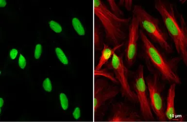 Anti-PARP antibody [HL1365] used in Immunocytochemistry/ Immunofluorescence (ICC/IF). GTX636805