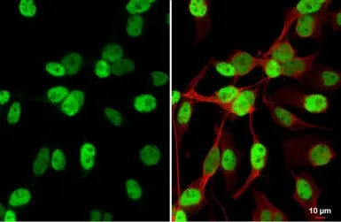 Anti-MyoD1 antibody [HL1372] used in Immunocytochemistry/ Immunofluorescence (ICC/IF). GTX636812