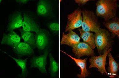 Anti-Mre11 antibody [HL1386] used in Immunocytochemistry/ Immunofluorescence (ICC/IF). GTX636826