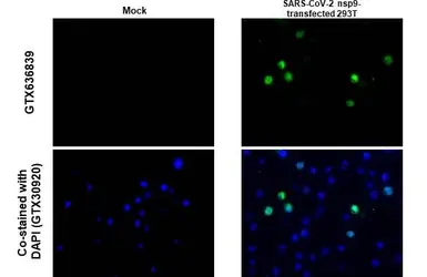 Anti-SARS-CoV-2 (COVID-19) nsp9 antibody [HL1399] used in IHC-P (cell pellet) (IHC-P (cell pellet)). GTX636839