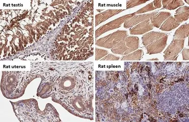 Anti-Carbonic Anhydrase IX antibody [HL1410] used in IHC (Paraffin sections) (IHC-P). GTX636876