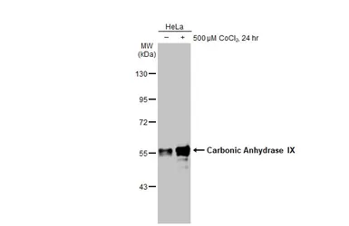 Anti-Carbonic Anhydrase IX antibody [HL1410] used in Western Blot (WB). GTX636876