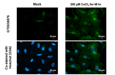 Anti-Carbonic Anhydrase IX antibody [HL1410] used in Immunocytochemistry/ Immunofluorescence (ICC/IF). GTX636876