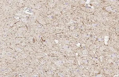 Anti-FCER1G antibody [HL1418] used in IHC (Paraffin sections) (IHC-P). GTX636884