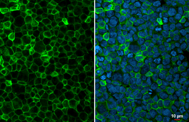 Anti-FCER1G antibody [HL1418] used in Immunocytochemistry/ Immunofluorescence (ICC/IF). GTX636884