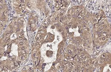 Anti-IL1 beta antibody [HL1421] used in IHC (Paraffin sections) (IHC-P). GTX636887