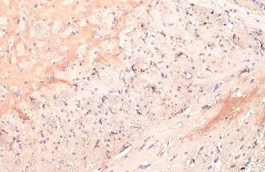 Anti-IL1 beta antibody [HL1421] used in IHC (Paraffin sections) (IHC-P). GTX636887