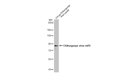 Anti-Chikungunya virus nsP2 antibody [HL1431] used in Western Blot (WB). GTX636897