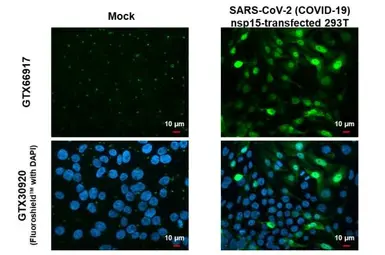 Anti-SARS-CoV-2 (COVID-19) nsp15 antibody [HL1445] used in Immunocytochemistry/ Immunofluorescence (ICC/IF). GTX636917