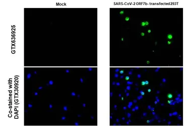 Anti-SARS-CoV-2 (COVID-19) ORF7b antibody [HL1453] used in IHC-P (cell pellet) (IHC-P (cell pellet)). GTX636925