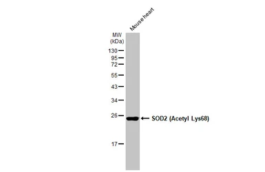 Anti-SOD2 (Acetyl Lys68) antibody [HL1460] used in Western Blot (WB). GTX636934