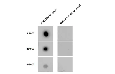 Anti-SOD2 (Acetyl Lys68) antibody [HL1460] used in Dot blot (Dot). GTX636934