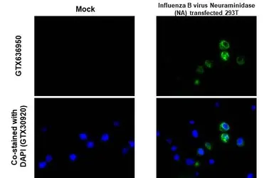 Anti-Influenza B virus Neuraminidase (NA) antibody [HL1476] used in IHC-P (cell pellet) (IHC-P (cell pellet)). GTX636950