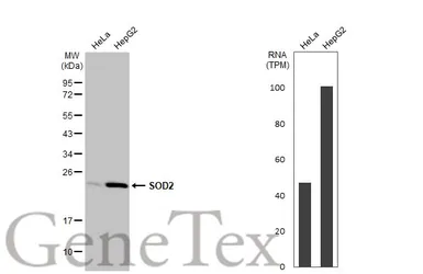 Anti-SOD2 antibody [HL1483] used in Western Blot (WB). GTX636957