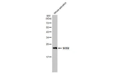 Anti-SOD2 antibody [HL1483] used in Western Blot (WB). GTX636957