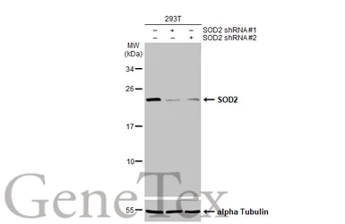 Anti-SOD2 antibody [HL1483] used in Western Blot (WB). GTX636957