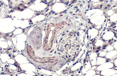 Anti-SOD2 antibody [HL1483] used in IHC (Paraffin sections) (IHC-P). GTX636957