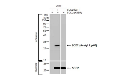 Anti-SOD2 antibody [HL1483] used in Western Blot (WB). GTX636957