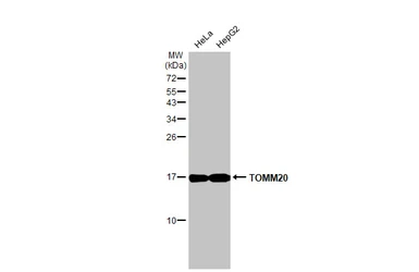 Anti-TOMM20 antibody [HL1494] used in Western Blot (WB). GTX636968