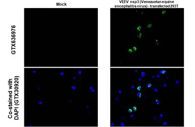 Anti-Venezuelan Equine Encephalitis Virus nsP3 antibody [HL1502] used in IHC-P (cell pellet) (IHC-P (cell pellet)). GTX636976