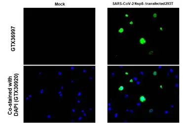 Anti-SARS-CoV-2 (COVID-19) nsp8 antibody [HL1523] used in IHC-P (cell pellet) (IHC-P (cell pellet)). GTX636997