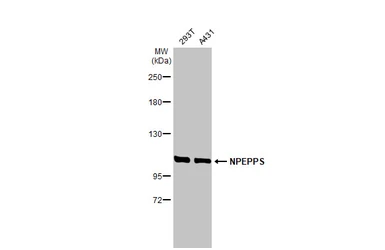 Anti-NPEPPS antibody [HL1531] used in Western Blot (WB). GTX637005