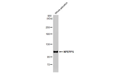 Anti-NPEPPS antibody [HL1531] used in Western Blot (WB). GTX637005