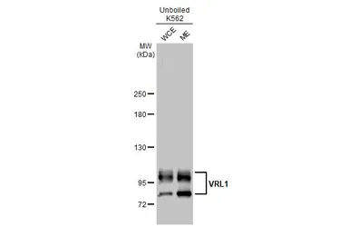 Anti-VRL1 antibody [HL1543] used in Western Blot (WB). GTX637018