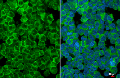 Anti-VRL1 antibody [HL1543] used in Immunocytochemistry/ Immunofluorescence (ICC/IF). GTX637018