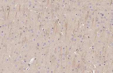 Anti-VRL1 antibody [HL1543] used in IHC (Paraffin sections) (IHC-P). GTX637018