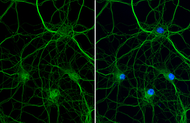 Anti-VRL1 antibody [HL1543] used in Immunocytochemistry/ Immunofluorescence (ICC/IF). GTX637018